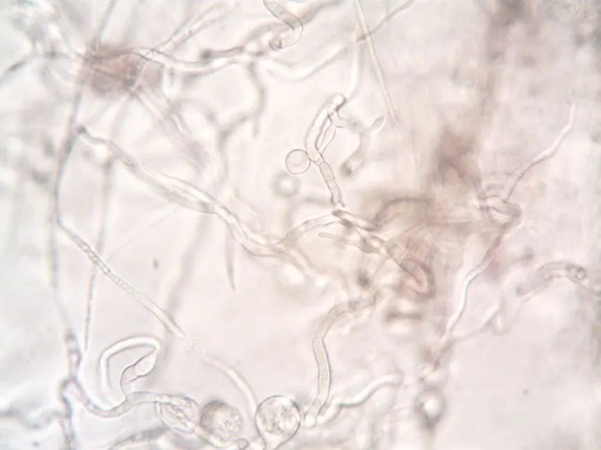 Mold removal vs. mold remediation: what's the difference?
